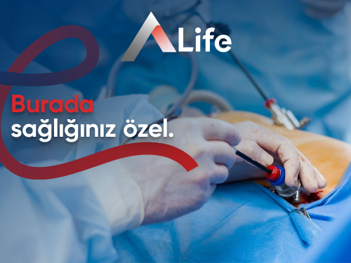 Laparotomi Nedir?